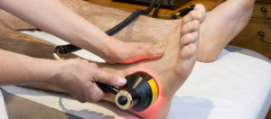 La fototerapia a basso livello aiuta la neuropatia?