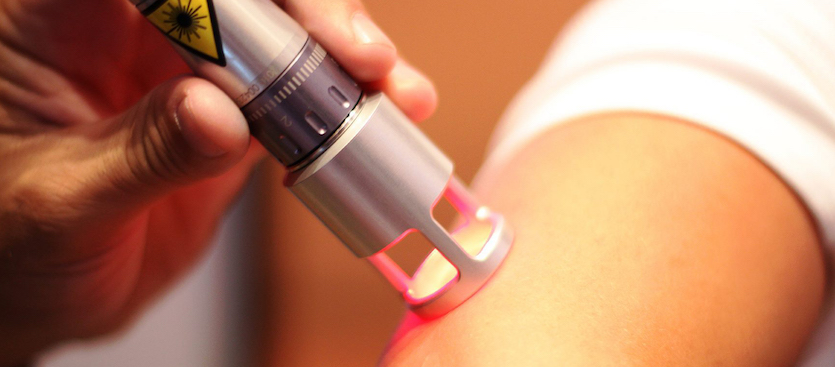 Microcorrente applicata dalla stimolazione di punti (MPS - Microcurrent Applied by Point Stimulation): una nuova speranza per il mal di schiena causato da neuropatia cronica Microcorrente applicata dalla stimolazione di punti (MPS - Microcurrent Applied by Point Stimulation): una nuova speranza per il mal di schiena causato da neuropatia cronica